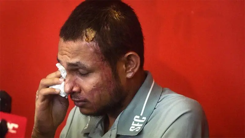 Faisal Halim khóc ở cuộc họp báo ngày 13/6, trong lần đầu xuất hiện trước công chúng sau khi bị tấn công bằng axit ngày 5/5